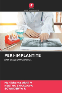Peri-Implantite