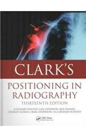 Clark’s Positioning in Radiography
