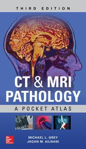 CT & MRI Pathology: A Pocket Atlas, Third Edition