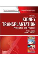 Kidney Transplantation with Access Code