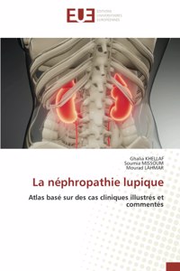 La néphropathie lupique