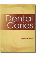 Dental Caries